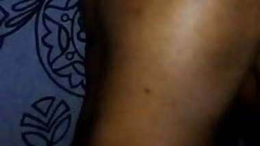 Discharge on buttocks